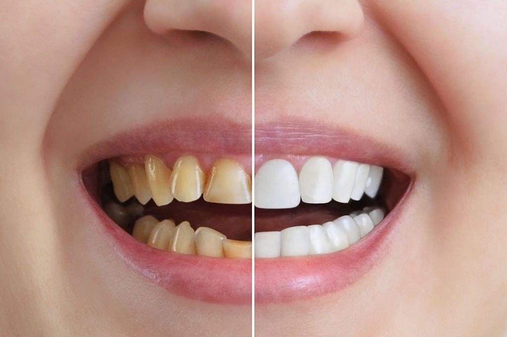 Benefits of Cosmetic Dentistry Beyond Aesthetics